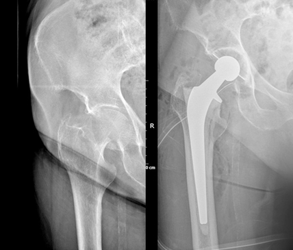 Slider image (6) Dr. Metztli Linette Gomez Espinoza - Orthopedic Clinic